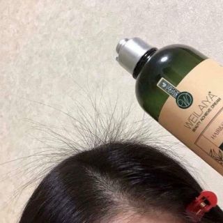 Bộ gội xả gừng weilaiya