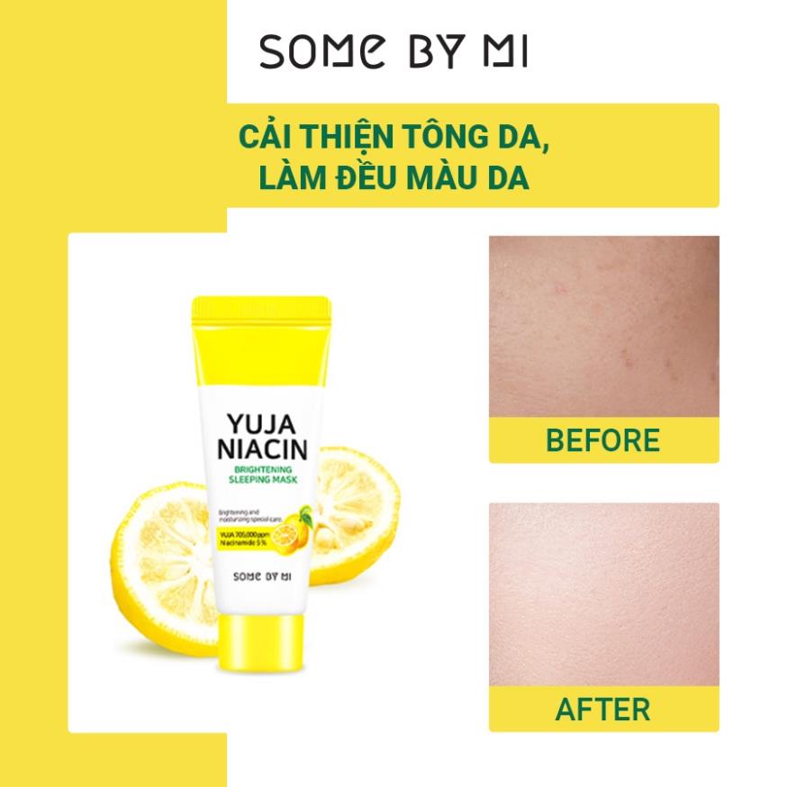 Hàng Công ty Bộ Kit Some By Mi Dưỡng Sáng Da Chiết Xuất Thanh Yên 4 Món Yuja Niacin 30 Days Miracle