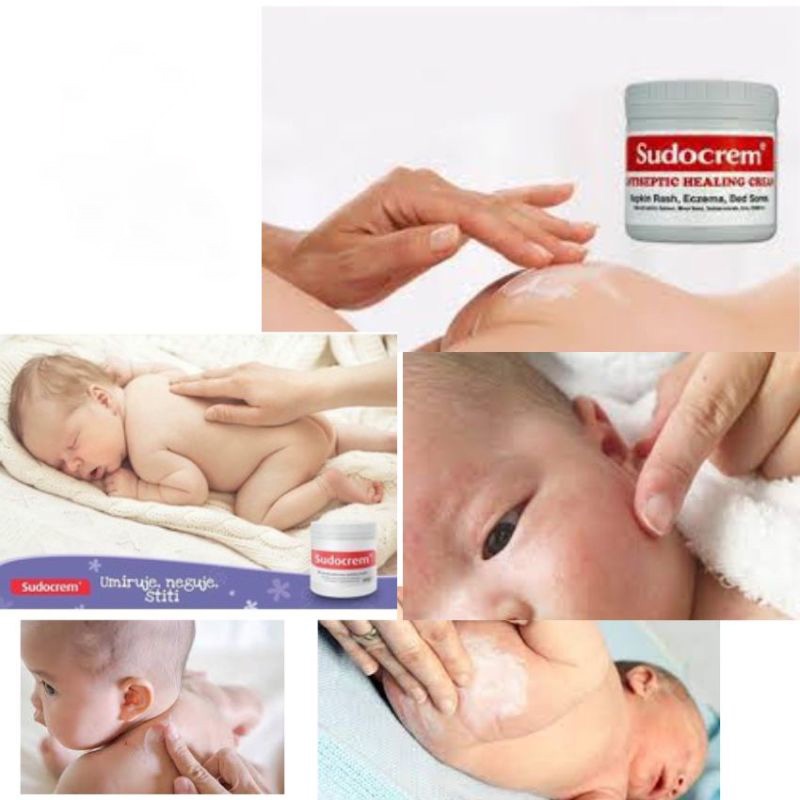 🦋giảm giá🦋Kem Hăm Tã Cho Trẻ Sơ Sinh Sudocrem Nội Địa Anh 60g, 125g