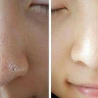Serum Se Lỗ Chân Lông (estee lauder idealist Pore Minimizing)
