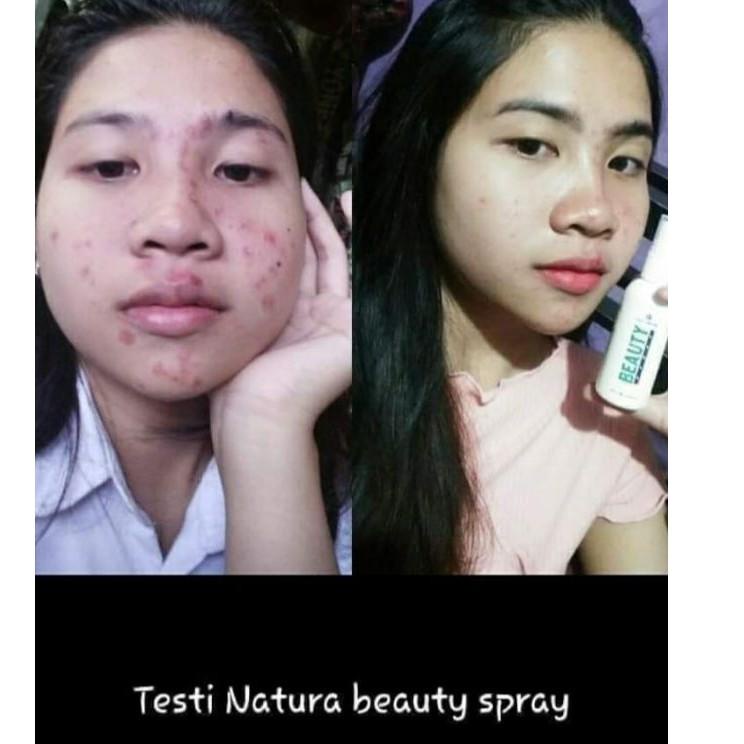 Bình Xịt Làm Đẹp Tự Nhiên 100%EF39 (Trims,.) | BigBuy360 - bigbuy360.vn