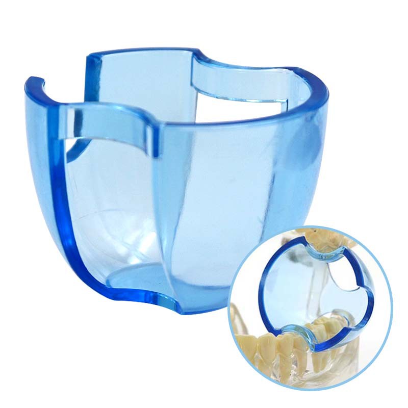 Dụng Cụ Hỗ Trợ Mở Miệng Nha Khoa Tiện Lợi