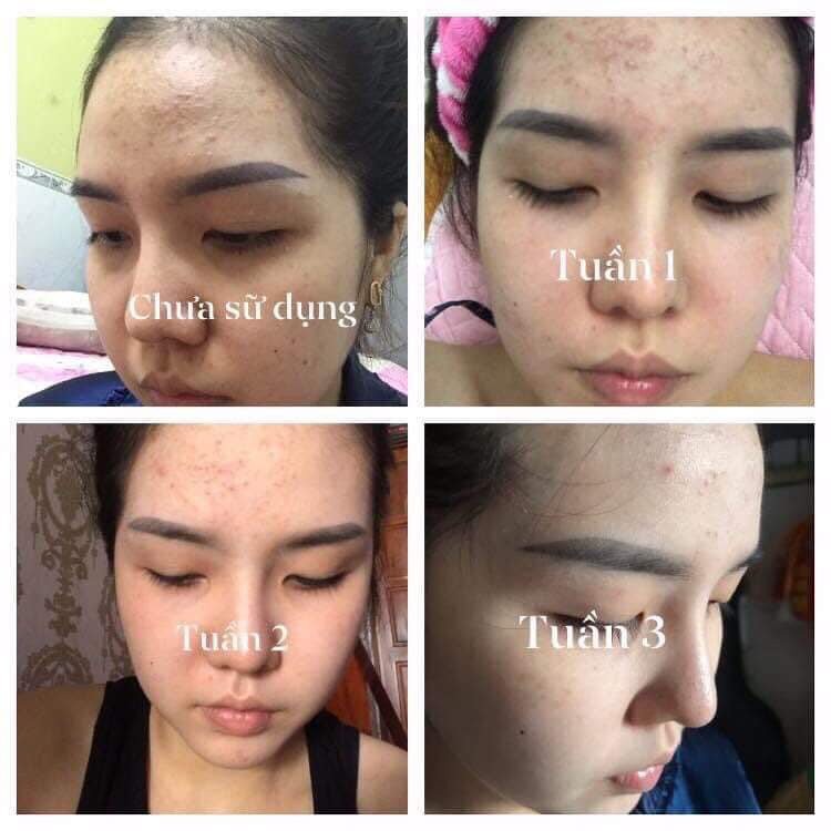 Nhụy Hoa Nghệ Tây Cao Lá Nam Mua Sỉ Giảm Cực Sâu | BigBuy360 - bigbuy360.vn