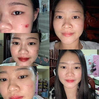 THẢO DƯỢC NHÂN SÂM TÁI TẠO DA HANDMADE