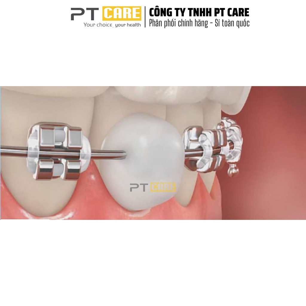 PT CARE | 01 Hộp Sáp Nha Khoa 3M Unitek Mỹ Cho Người Niềng Răng Chỉnh Nha Đau Mắc Cài Viêm Nướu