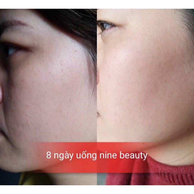 Viên uống trắng da Nine's Beauty‼️ Trắng da, mờ nám, giảm nếp nhăn (9 ngày)