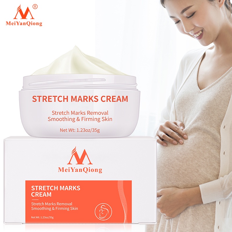 Meiyanqiong Stretch Mark Cream Làm Trắng Và Săn Chắc Mịn Mượt Chống Lão Hóa Giảm rạn da Kem dưỡng ẩm 35g