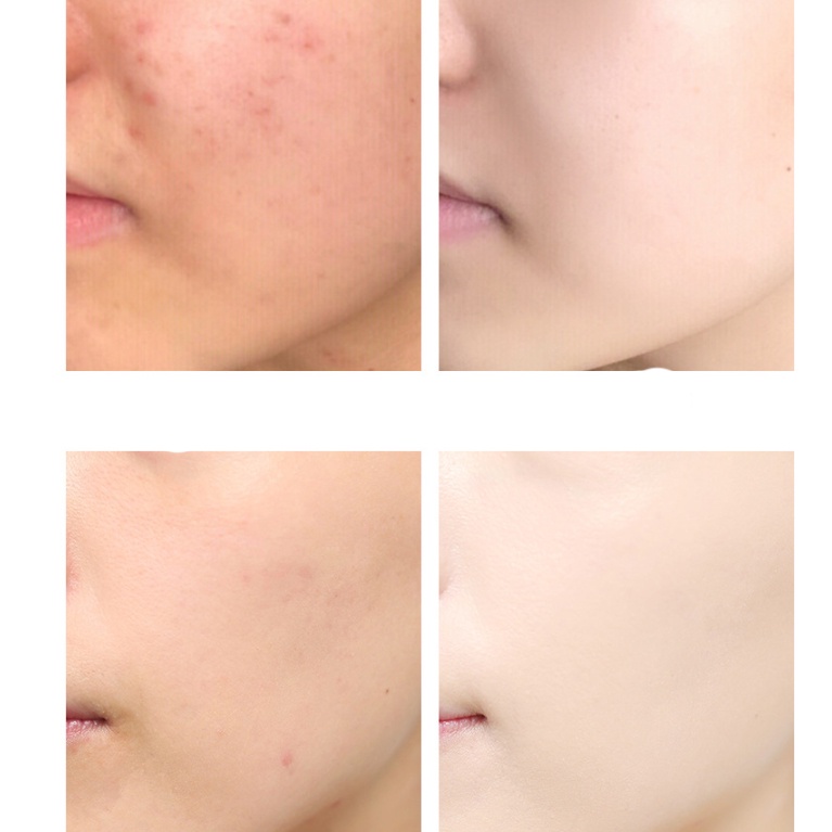 Tinh chất làm trắng IMAGE hexapeptide làm sáng da, dưỡng ẩm, làm mềm da 30ml