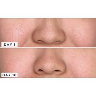 [100% AUTH] Tinh Chất Se Khít Lỗ Chân Lông Cosrx Two in One Poreless Power Liquid 100ml