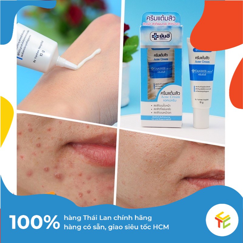 Kem Sạch Mụn &amp; Làm Mờ Vết Thâm Yanhee Acne Cream Nhập Khẩu từ Thái Lan