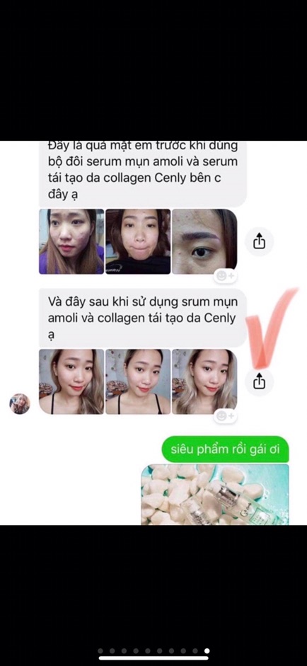 Serum Collagen Tái Tạo Da Amoliskin | BigBuy360 - bigbuy360.vn