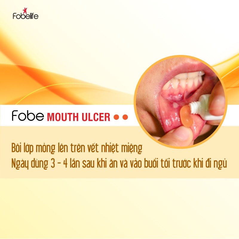 Gel nhiệt miệng Fobe moulth ulcer tuýp 15g