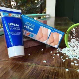 Kem trị nứt gót chân kpem-nga