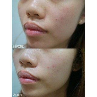 Serum Klairs Rich Moist Cấp ẩm