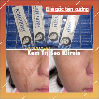 kem trị seo nga chính hãng