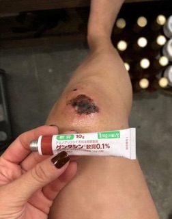 Kem trị sẹo Gentacin Nhật Bản