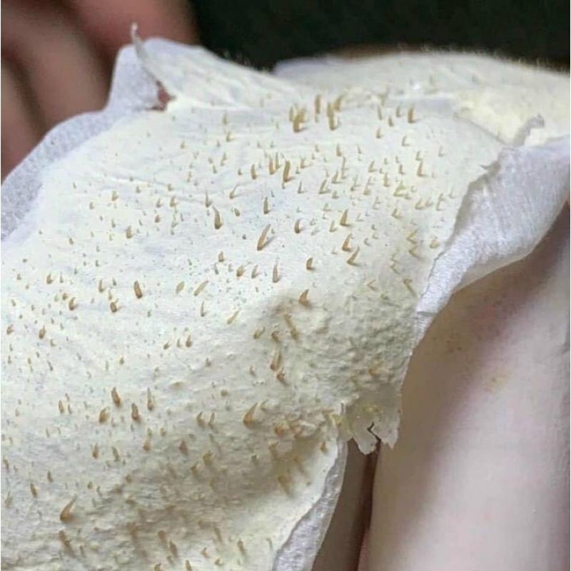 Keo lột mụn handmade