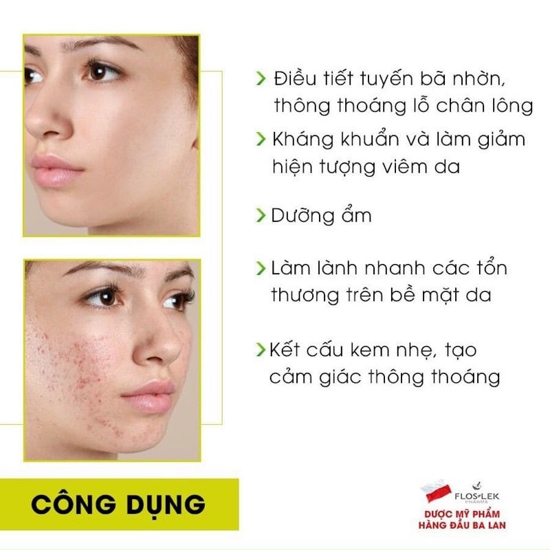 Kem kiểm soát dầu và điều tiết nhờn Floslek Anti Acne Mattifying Cream 50ml