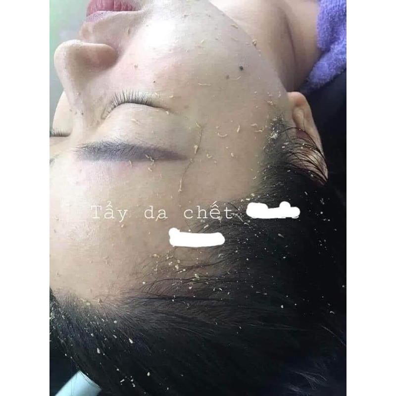 TẨY TẾ BÀO CHẾT SICA