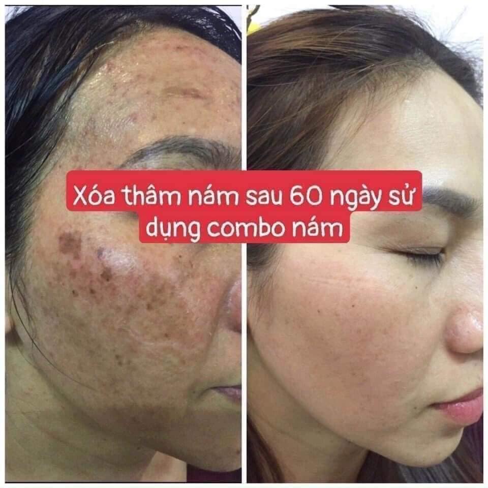 Cao nám Insam Dr Cell làm đẹp da, chống lão hóa, chống nhăn da 20ml SAN16