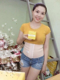 Đai nịt bụng, nịch bụng