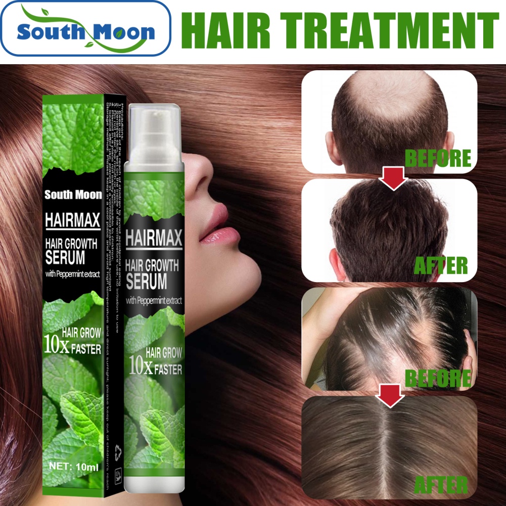 Xịt mọc tóc EELHOE chiết xuất gừng chống rụng/ hỗ trợ da đầu/ làm đẹp nhanh chóng cho nam nữ 2023