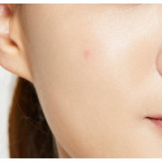 [Hàng mới về] Miếng dán mụn COSRX chăm sóc da (24 miếng)