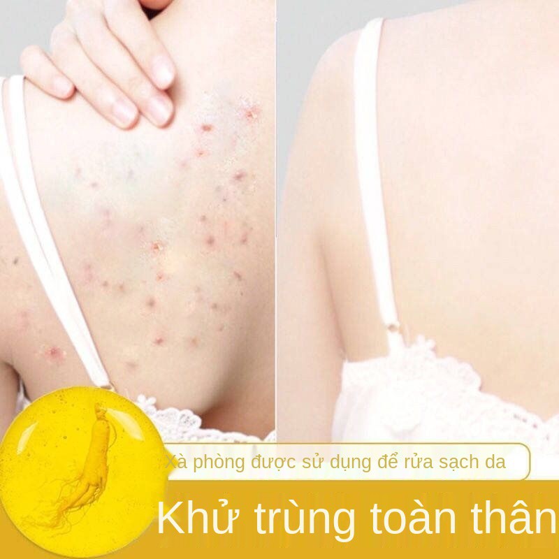 [Trừ Mite Sophora Soap] Nhân sâm chính hãng được giới thiệu và hướng dẫn sử dụng Xà phòng loại bỏ mạt đánh bay mụn cám,