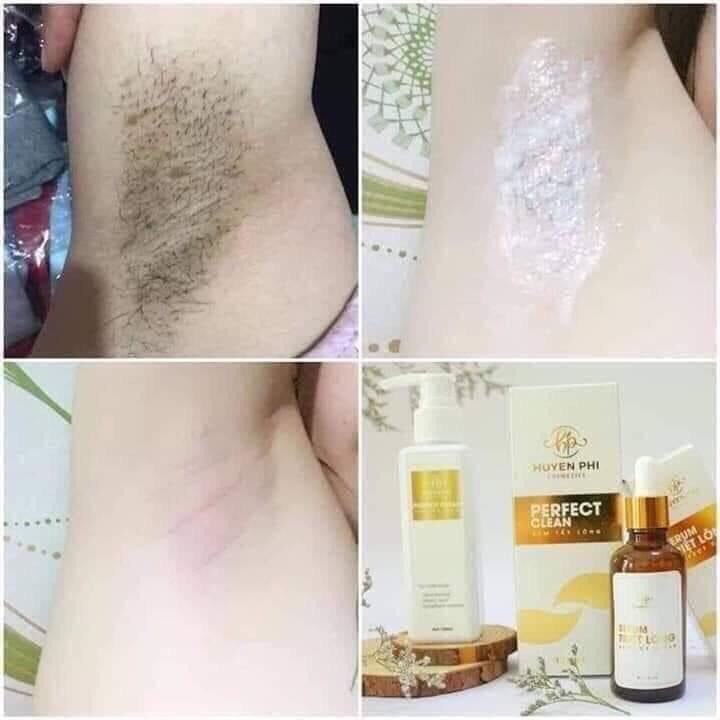 Kem Tẩy Lông Huyền Phi [ Mua 1 Tặng 1 Serum] triệt lông tận gốc, lông nách, lông bikini, ria mép, râu,triệt mùi hôi nách | BigBuy360 - bigbuy360.vn