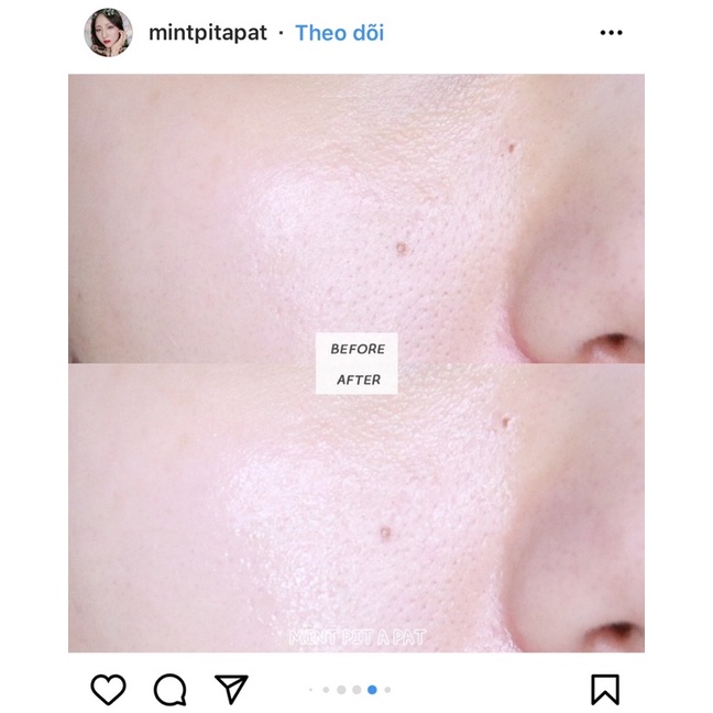 80ml  Tinh chất phục hồi da Bifida Biome Complex Ampoule