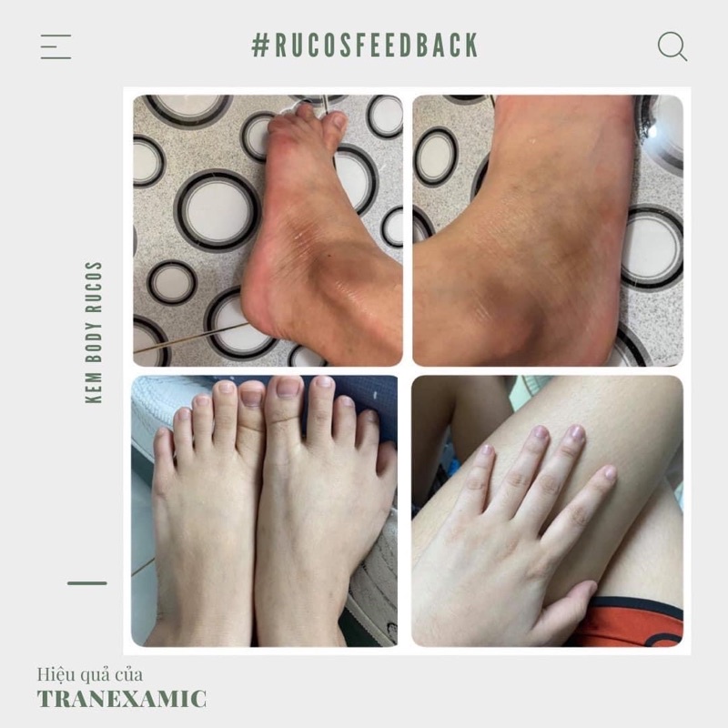 Kem Dưỡng Trắng Da Body Rucos Đen- Làm Đẹp cùng August