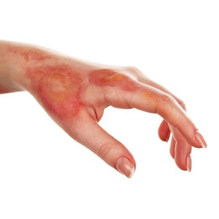 Xịt bỏng Panthenol Xịt Mẫu Mới ✅(Chính Hãng 100%)
