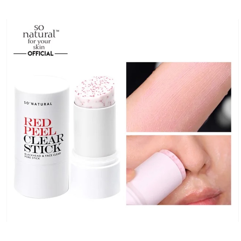 Thanh Lăn Trị Mụn Đầu Đen, Điều Tiết Bã Nhờn So' Natural Red Peel Clear Stick 23g