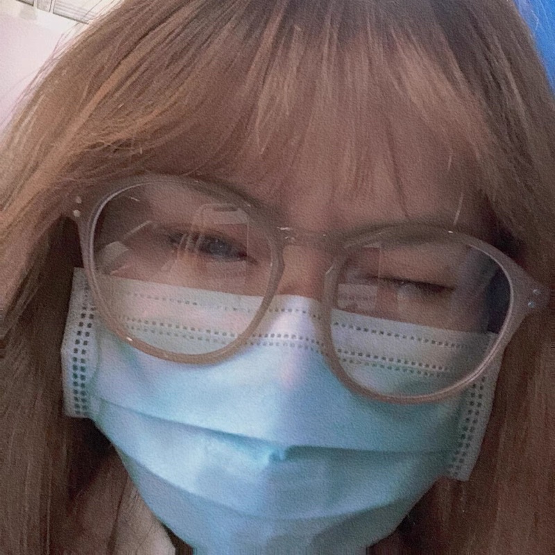 Kính nhựa bầu tròn 2 chấm mẫu mới