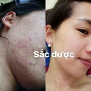 Sữa rửa mặt đông y