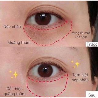 Kem mắt AHC - 𝗠𝗮̂̃𝘂 𝘅𝗮𝗻𝗵 2021