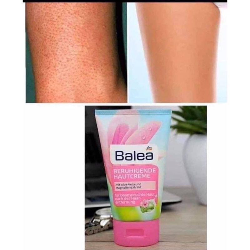 Kem dưỡng sau wax lông Balea | BigBuy360 - bigbuy360.vn