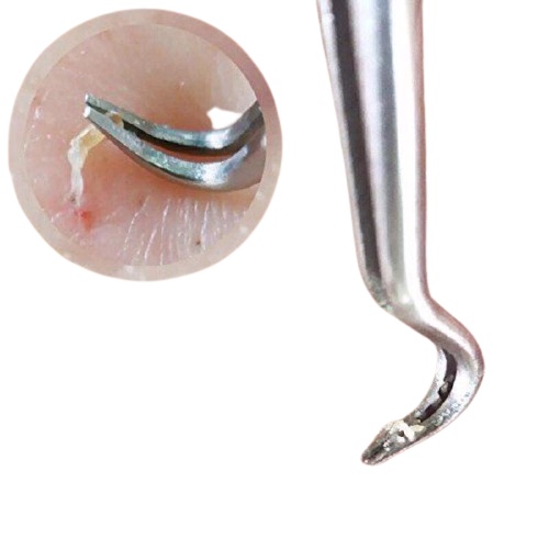 Nhíp gắp mụn Vacosi Hàn Quốc - Nhíp gắp mụn đầu đen Vacosi T07