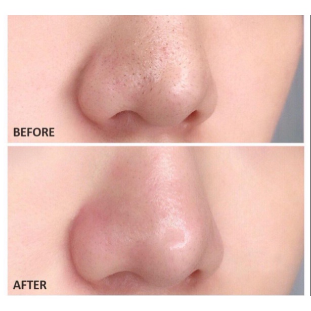 Kỳ Da Chết Từ Lợi Khuẩn Lên Men Bí Đỏ Peacholic 100ml