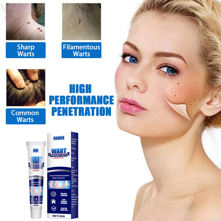 Tuýp Kem Hỗ Trợ Giảm Mụn Cóc Và Đốm Nâu Tự Nhiên 20g JMMZ