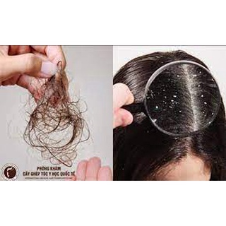 💖 HÀNG CHUẨN 💖 𝐂𝐚̣̆𝐩 𝐝𝐚̂̀𝐮 𝐠𝐨̣̂𝐢 đ𝐚̂̀𝐮 𝐭𝐫𝐢̣ 𝐫𝐮̣𝐧𝐠 𝐭𝐨́𝐜 , 𝐭𝐫𝐢̣ 𝐧𝐚̂́𝐦 𝐧𝐠𝐮̛́𝐚 𝐝𝐚 đ𝐚̂̀𝐮 𝐡𝐢𝐞̣̂𝐮 𝐪𝐮𝐚̉
