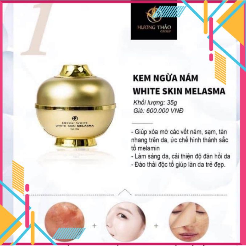 Kem ngừa nám white skin melasma detox white 35g