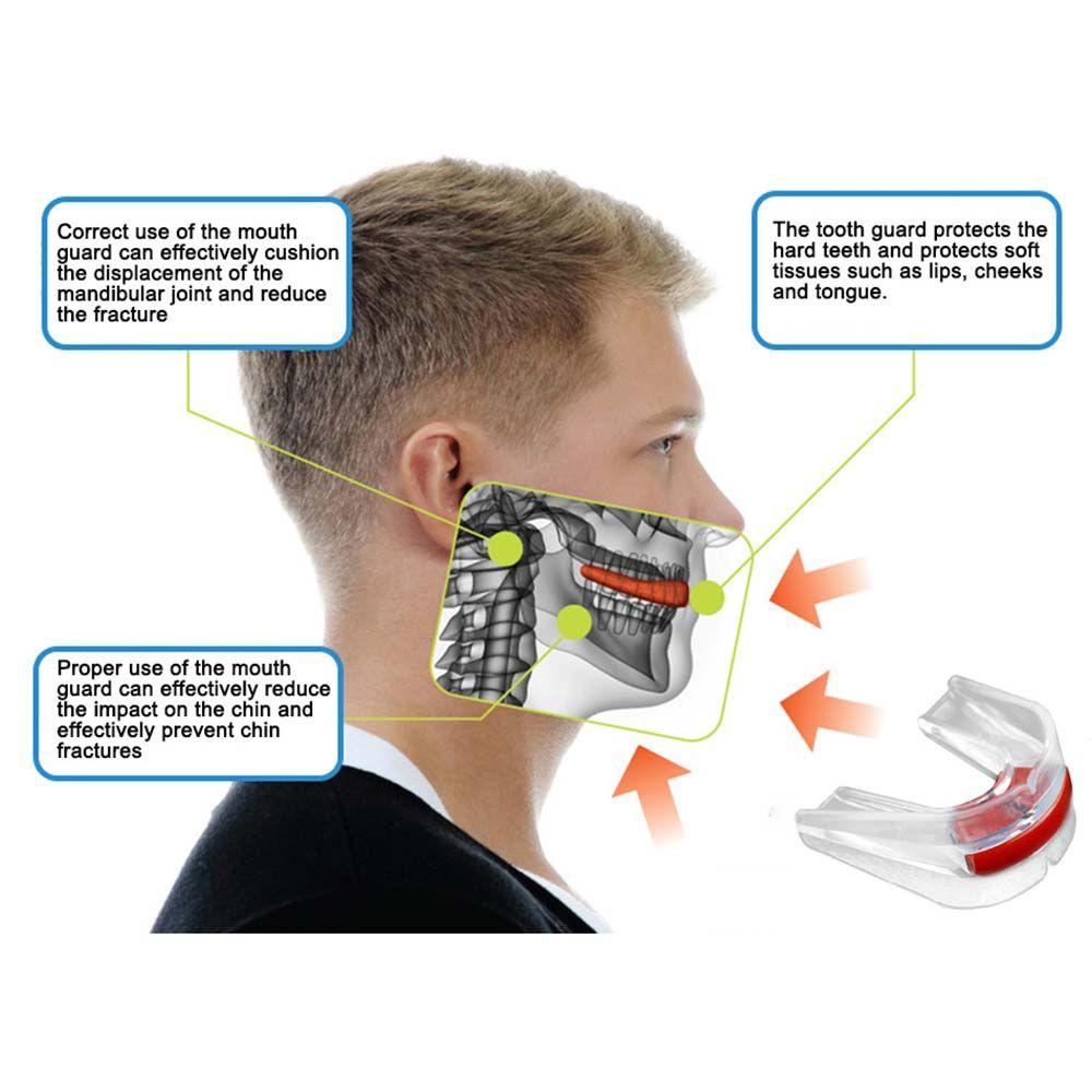 Hộp Bảo Vệ Răng Trong Suốt Khi Chơi Thể Thao Boxing