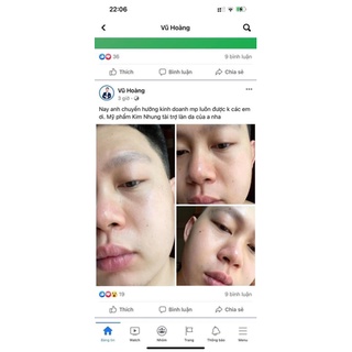 KEM DƯỠNG TRẮNG DA MẶT