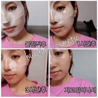 Mặt nạ Derm all matrix