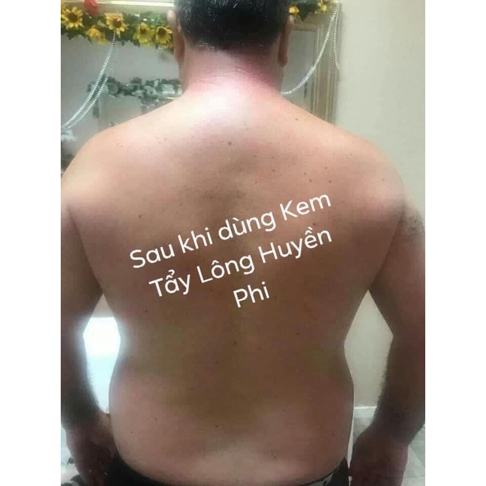 Serum Khử Mùi Hôi Nách INOD Huyền Phi, Hôi Chân, Mùi Cơ Thể, Serum triệt lông Huyền Phi | BigBuy360 - bigbuy360.vn