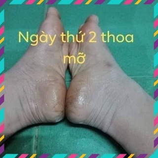 Mỡ trăn triệt lông