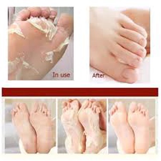 Ủ chân Nhật Bản