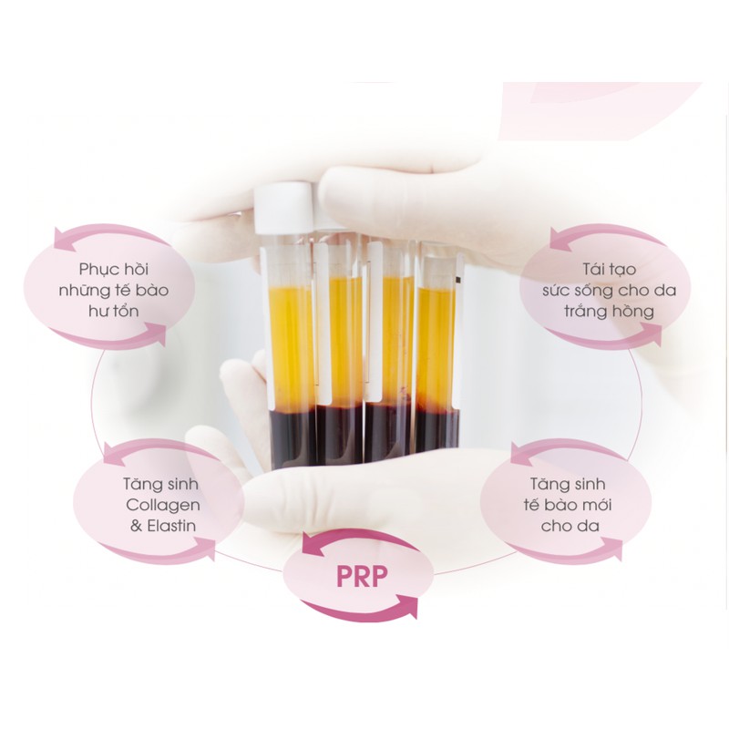 Hộp 100 Ống nghiệm ACD dùng lấy máu chân không trong PRP 8,5ml hàng USA