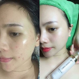 Ủ trắng kén tằm